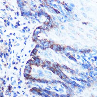 Immunohistochemistry-Paraffin: PDGFA Antibody - Azide and BSA Free [NBP3-05169]